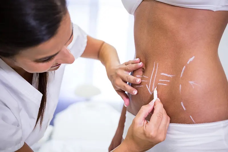 Cosmetic surgery loan for liposuction