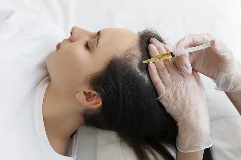 Scalp transplant financing solutions