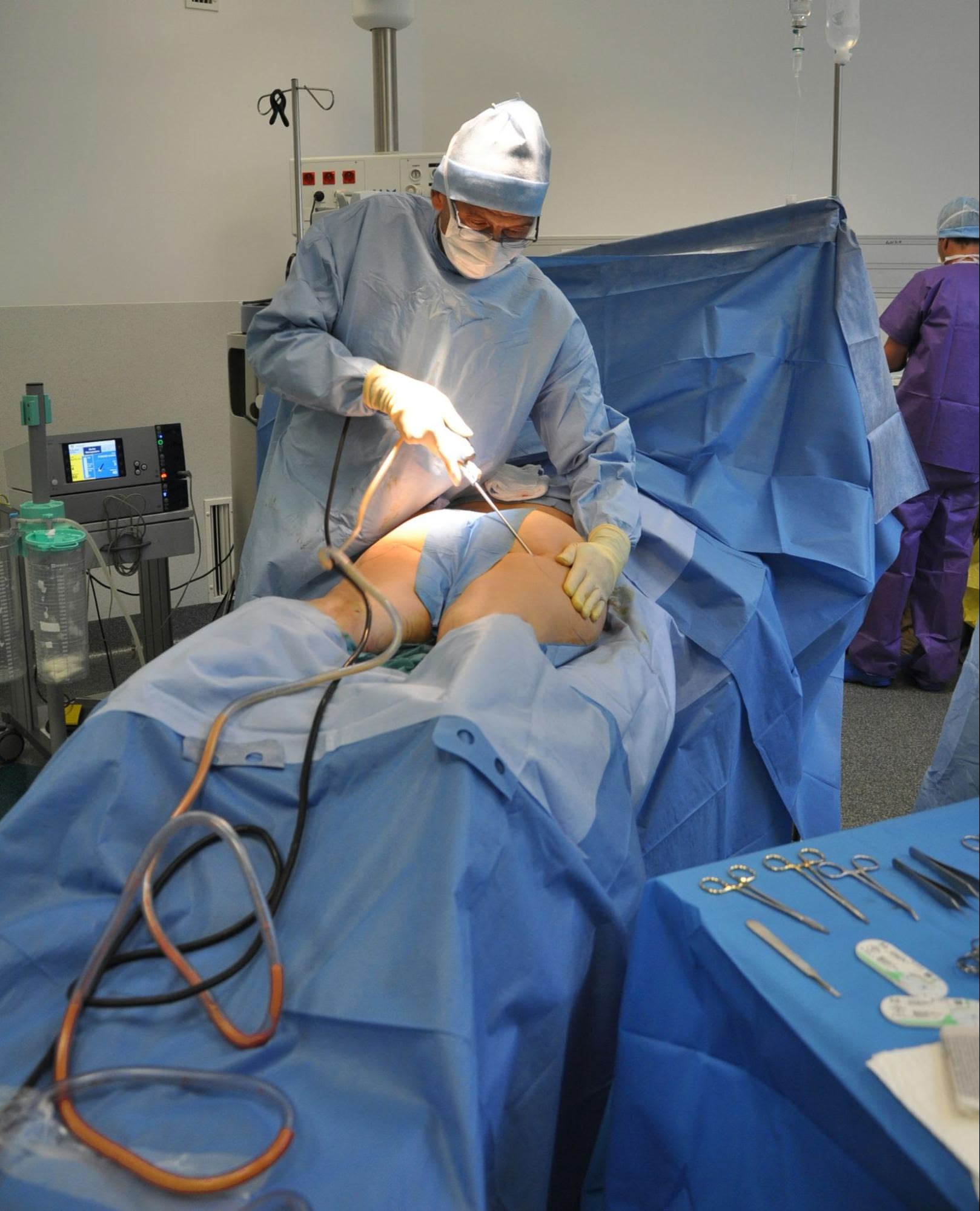 educate patients about liposuction loans